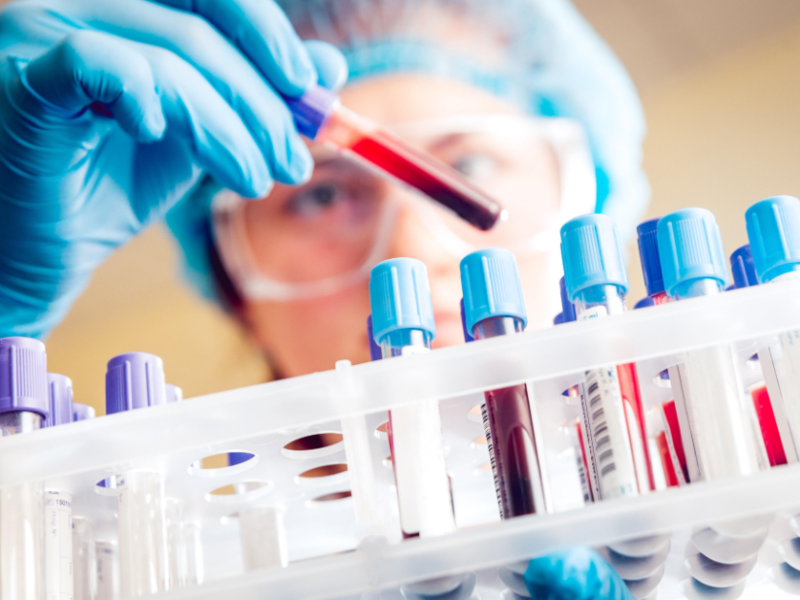 Aportes del laboratorio al diagnóstico de equinococosis quística