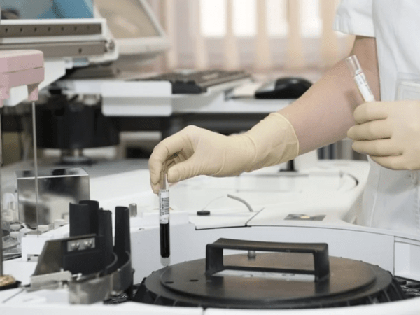 El rol clave del laboratorio en el hallazgo de Marcadores vinculados al Trastorno por Consumo de Alcohol