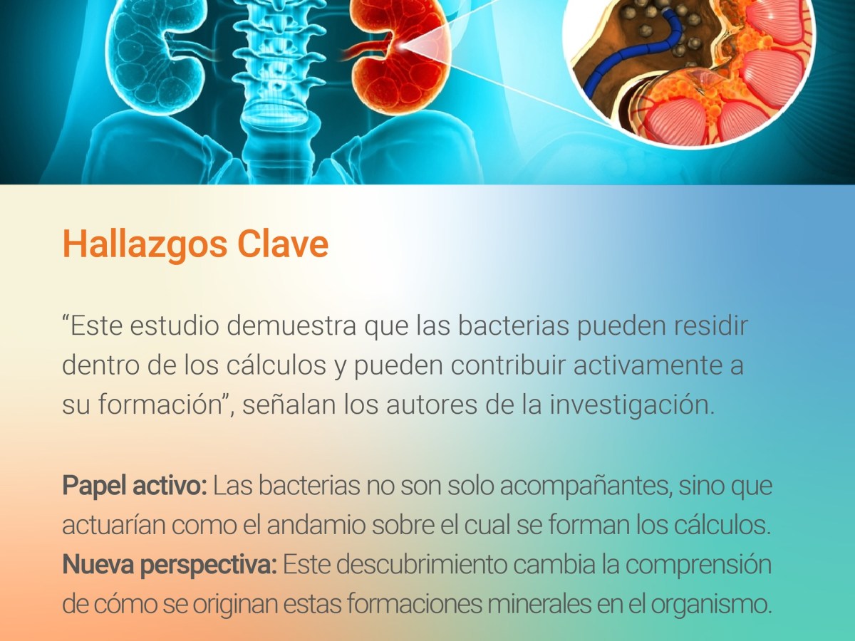 Cálculos renales: un nuevo rol para las bacterias