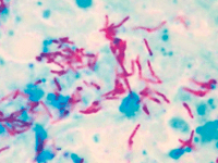 Descubrimiento clave: nuevo mecanismo facilita la supervivencia del Mycobacterium tuberculosis