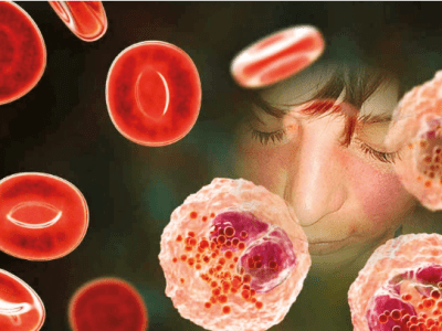 Acta Bioquímica Clínica Latinoamericana: Lupus eritematoso sistémico y autoanticuerpos