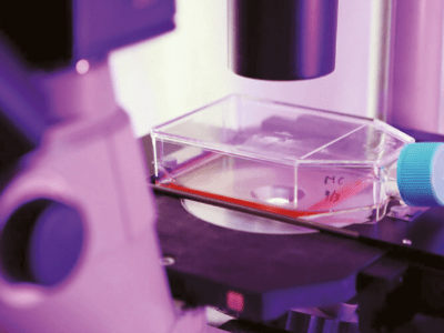 Síndrome metabólico y metformina: impacto en huesos y arterias