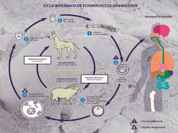 Equinococosis quística o hidatidosis