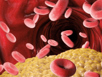 Lipoproteína (a): del desafío analítico a la responsabilidad clínica